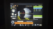 RetiWave 1000 Ophthalmic Ultrasound Scanner AB Scan Biometry IOL Calculation Eye Diagnostic Ultrasound System