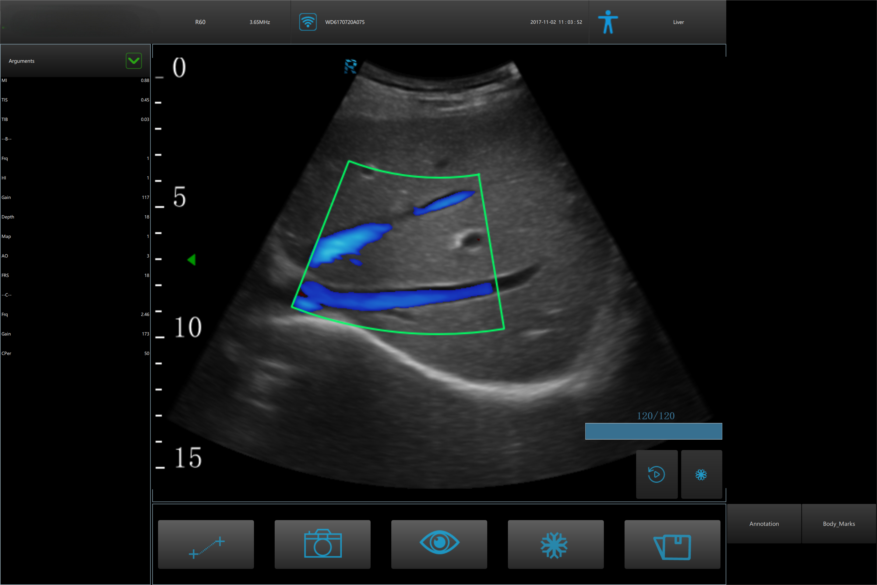 Advances in Ultrasound Imaging Technology