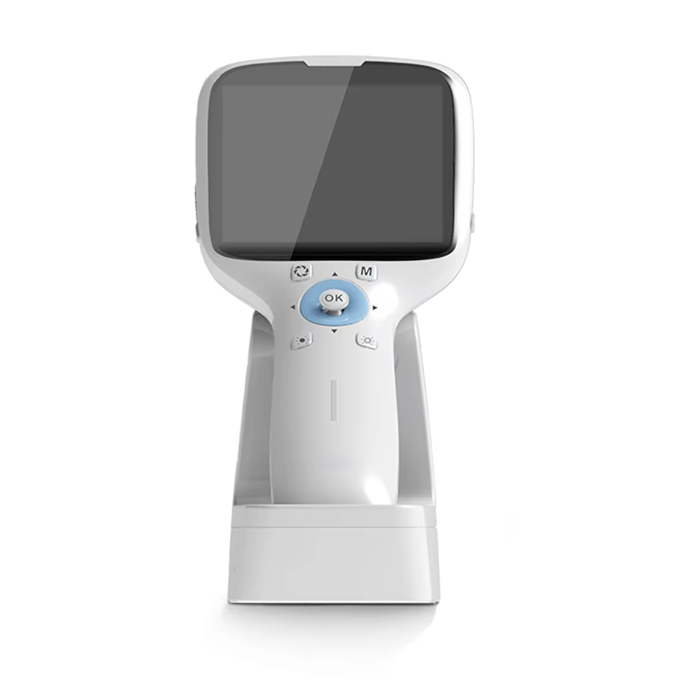 High pixel Hand-held fundus camera