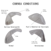 Cornea Eyeball Model Human Eye Model Human Eye Demonstration Teaching Prop Anatomy Medical Teaching Model