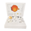 4X Cataract Eyeball Model Eye Various Cataracts Anatomy Teaching And Patient Demonstration Cataract