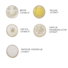 4X Cataract Eyeball Model Eye Various Cataracts Anatomy Teaching And Patient Demonstration Cataract