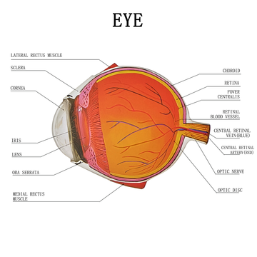 4X Cataract Eyeball Model Eye Various Cataracts Anatomy Teaching And Patient Demonstration Cataract