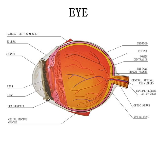 4X Cataract Eyeball Model Eye Various Cataracts Anatomy Teaching And Patient Demonstration Cataract