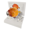 4X Cataract Eyeball Model Eye Various Cataracts Anatomy Teaching And Patient Demonstration Cataract
