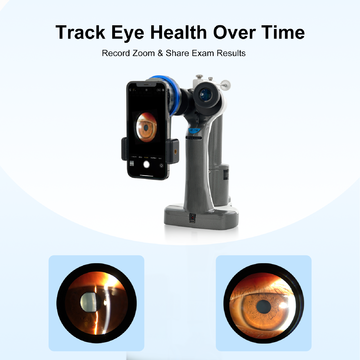 Handheld Slit Lamp FSL-P Ophthalmic Portable Slit Lamp for Hot Sale