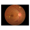 SK-650B Non-Mydriatic Fundus Camera 45° Digital Retinal Camera High Resolution Ophthalmic Fundus Imaging System with DICOM