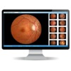 SK-650B Non-Mydriatic Fundus Camera 45° Digital Retinal Camera High Resolution Ophthalmic Fundus Imaging System with DICOM