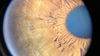 Digital Slit Lamp Imaging System for Slit Lamp Video Adapter with High Pixels for Clinical Ophthalmology Examinations
