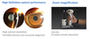 LS-1B high quality manufacturer low price ophthalmology portable slit lamp