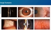 5 Steps LED Slit Lamp ML-350 Hot Selling Popular Hospital Approved Ophthalmic Equipment LED Microscope Digital Slit Lamp