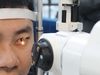 5 Steps LED Slit Lamp ML-350 Hot Selling Popular Hospital Approved Ophthalmic Equipment LED Microscope Digital Slit Lamp