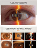Portable Pocket Slit Lamp 5X Magnification With LED Light Full Aluminum Sterilizable