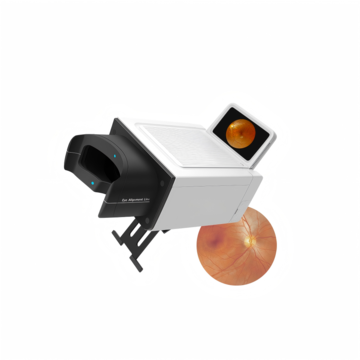 Automatic Ophthalmic Fundus Camera with Auto Alignment and High-Definition Retinal Images
