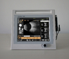 International Medical Certified Ultrasonic Optical Instruments Retiwave-1000 Ophthalmic AB Scan Ultrasound Machine