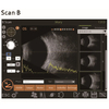 International Medical Certified Ultrasonic Optical Instruments Retiwave-1000 Ophthalmic AB Scan Ultrasound Machine